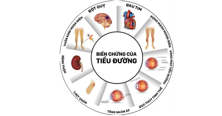 Tiểu đường có thể gây nhiều biến chứng nguy hiểm