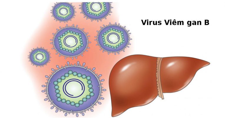 Viêm gan B là bệnh lý về gan thường gặp