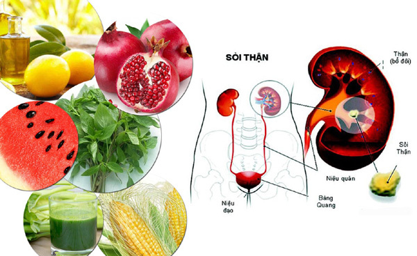 Một sô thực phẩm ngăn ngừa sỏi thận