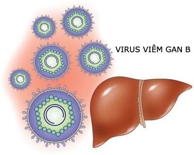 Viêm gan B là bệnh lý thường gặp ở gan