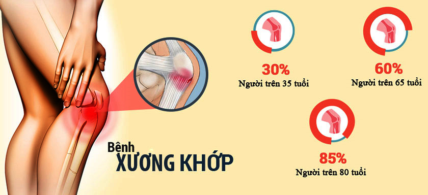 Đau nhức xương khớp có thể xuất hiện ở mọi lứa tuổi