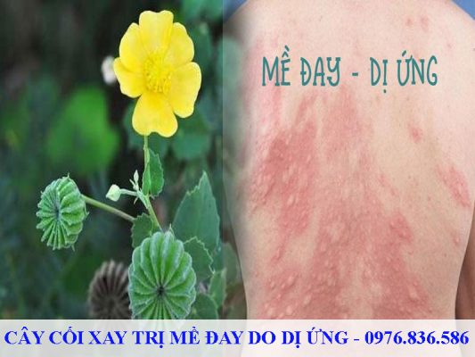 Lá cối xay có tác dụng trị mẩn ngứa hiệu quả