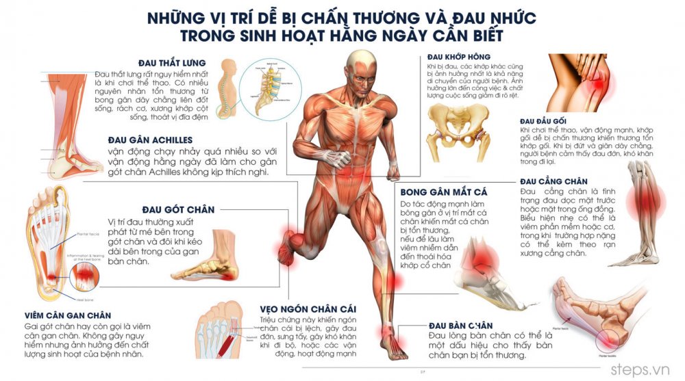 Có nhiều nguyên nhân dẫn tới chấn thương hàng ngày