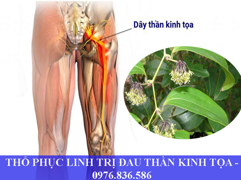 Thổ phục linh trị đau dây thần kinh tọa hiệu quả