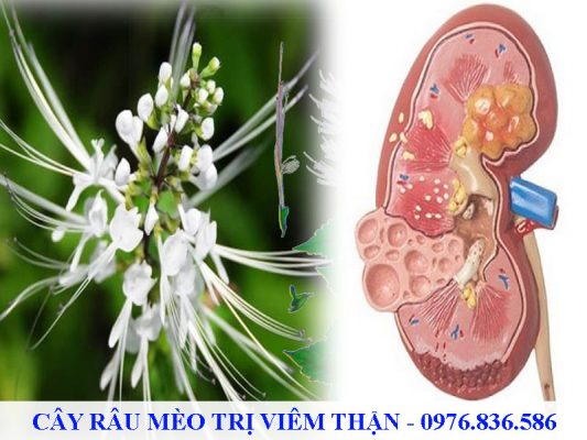 Cây râu mèo hỗ trợ điều trị viêm thận