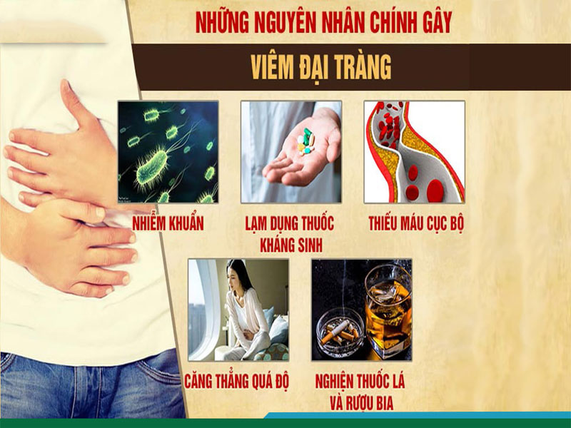 Một số nguyên nhân gây Viêm đại tràng mãn tính