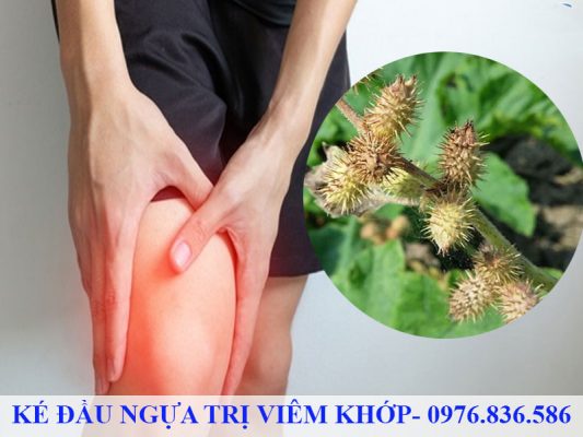 Ké đầu ngựa hỗ trợ điều trị bệnh đau nhức xương khớp