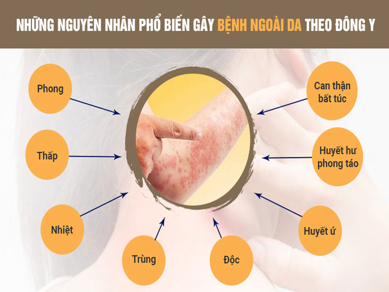 Một số nguyên nhân gây bệnh về da theo đông y